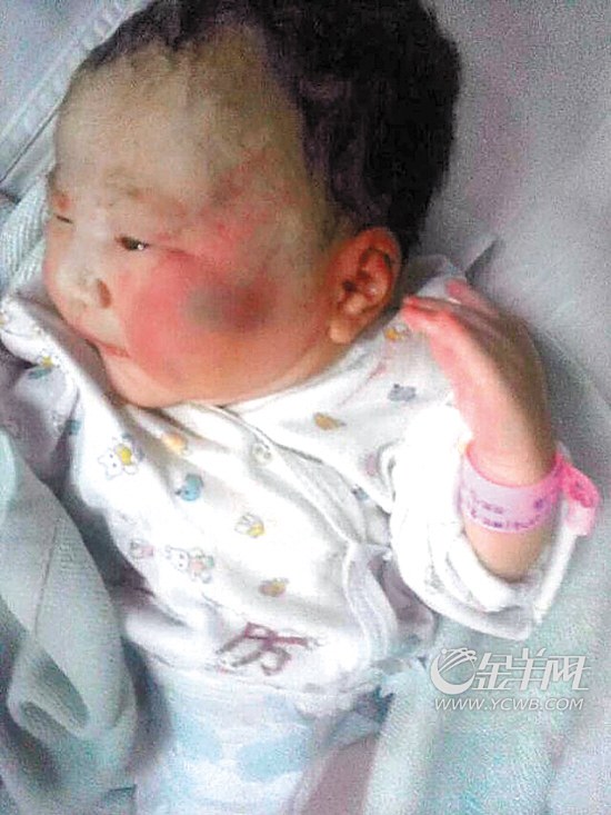 请问深圳龙岗妇幼生孩子需要什么证件吗-非深