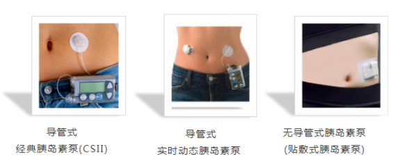 微泰胰岛素泵怎么样微泰医疗贴敷式胰岛素泵被权威指南收录！_https://www.jmylbn.com_新闻资讯_第2张